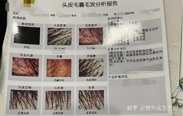 菏泽安全的植发机构诊所(中植植发是正规机构吗)