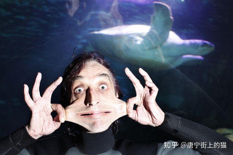 世界上皮肤最松弛的人脖子皮肤可以蒙住嘴背后原因令人唏嘘