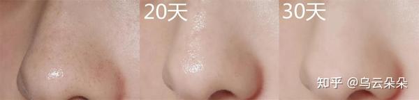护肤保养开课啦_26岁干性皮肤女人如何保养护肤_开护肤保养