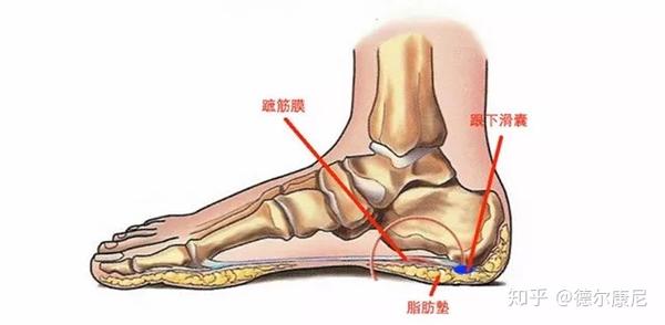 脚疼是怎么回事 不同位置疼痛的原因不同 这篇文章都说全了 知乎