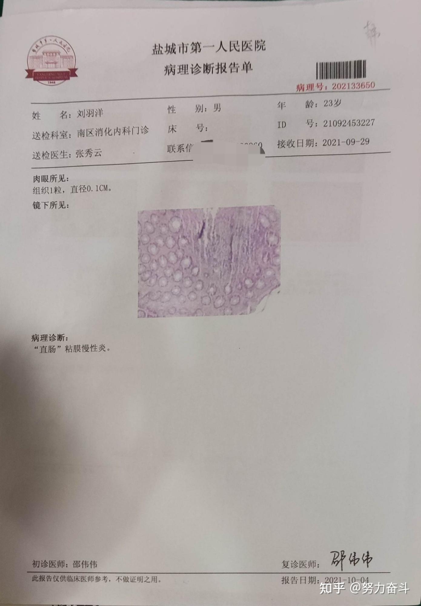 一个人做肠镜是什么感觉