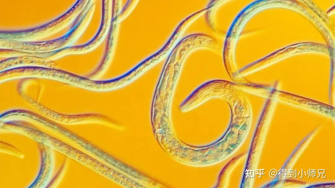 热搜榜首的虫子,吓到很多人!真是忍着巨大的恶心做完的线虫盘点(不适