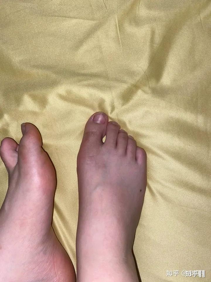 女生有一双很丑的脚有什么体验