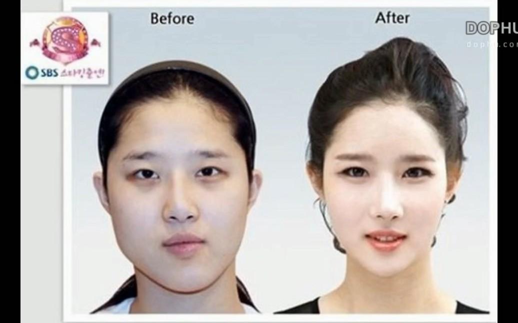 韩国可怕的整容文化