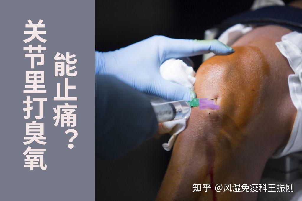 关节腔注射臭氧也能消炎止痛关节疼痛该不该用听听医生怎么说