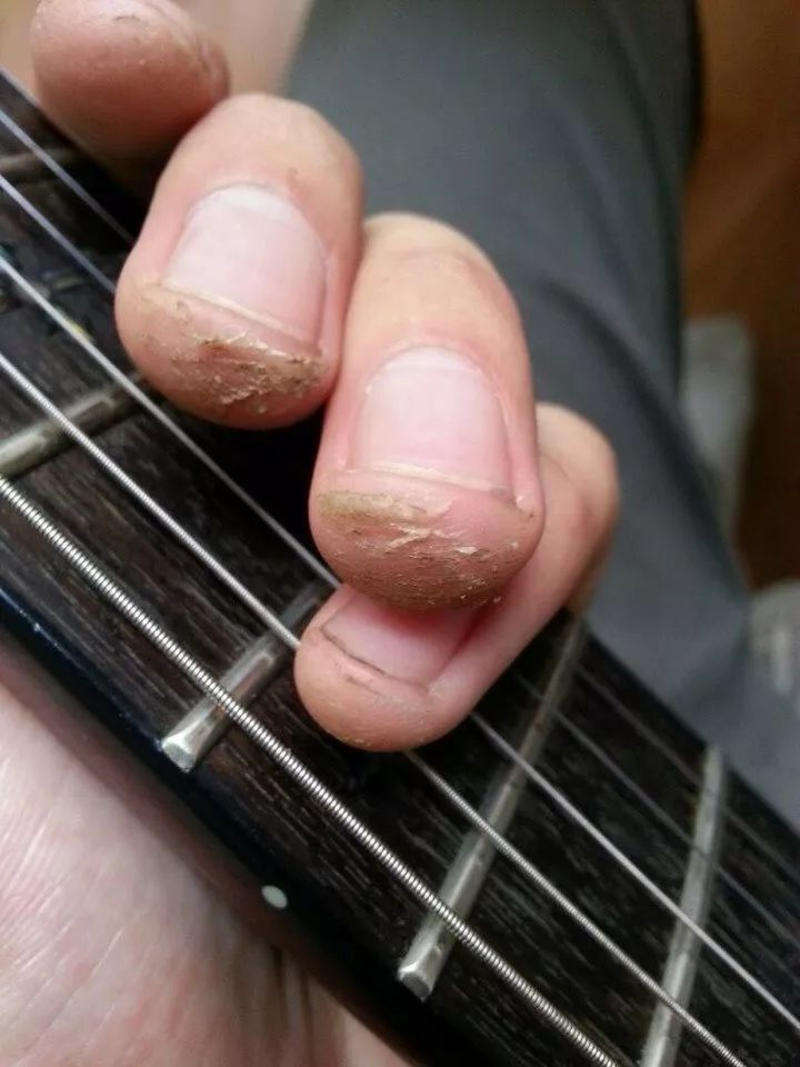 弹吉他左手茧子图片图片