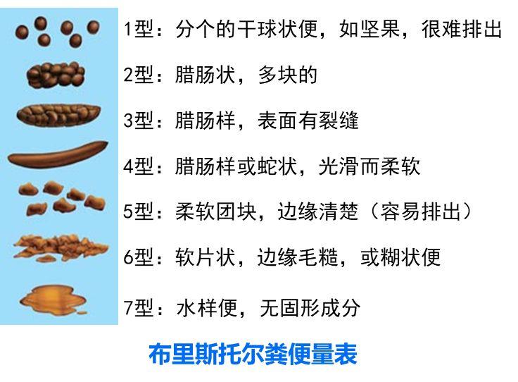 慢傳輸型便秘患者的腸道菌群在調節胃腸蠕動中的潛在作用菌群移植與