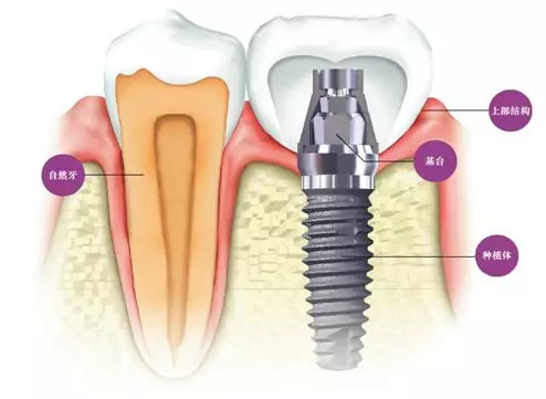 v2-ad140b8842e5cdec93a00f1c5bebe42f_1440w.jpg?source=172ae18b
