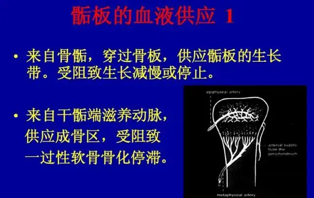 骨骺损伤的分型及影像表现 - 知乎
