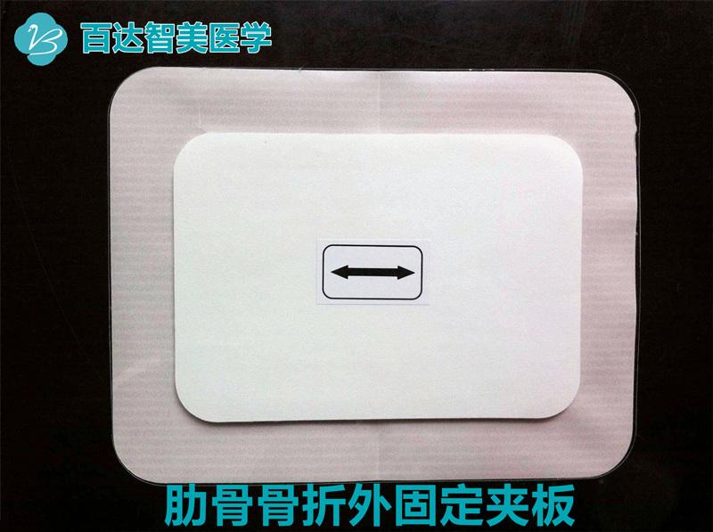 胸部肋骨骨折固定术用什么医用耗材 肋骨骨折外固定方法 百达智美医学胸骨 肋骨固定夹板简介 知乎 胸部肋骨骨折固定术用什么医用耗材 肋骨骨折外固定方法 百达智美医学胸骨 肋骨固定夹板简介 知乎