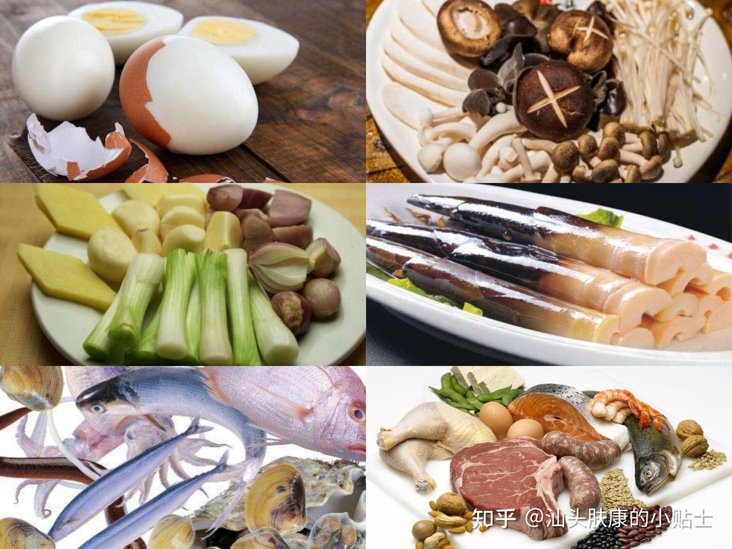 让你忌口你不忌,你** 荨麻疹不能吃的食物 - 知乎