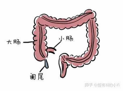 阑尾图片简笔画图片