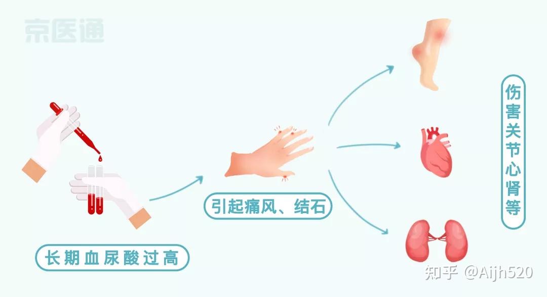“四高” 指标老年人的“健康标准”及饮食策略 - 知乎