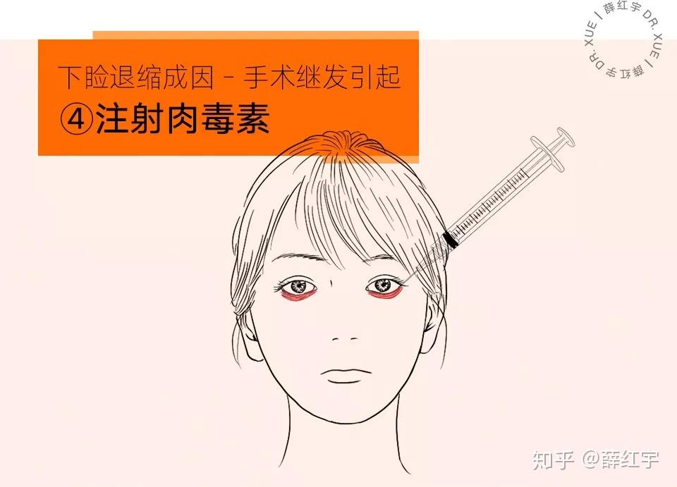 三白眼怎么办? - 知乎