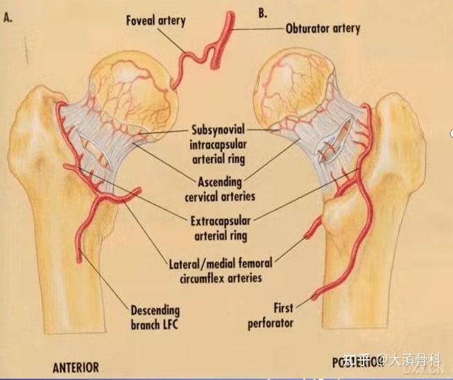 一文了解股骨颈骨折 - 知乎