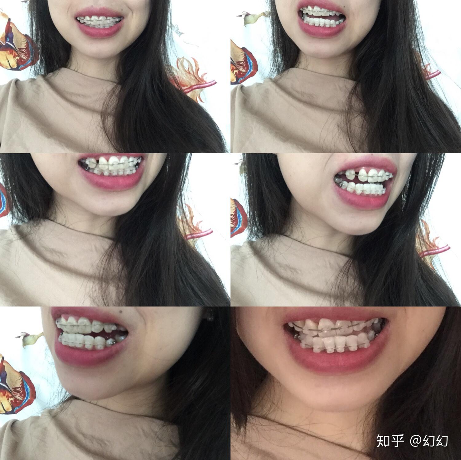 v2-adccf4a55c2ecfb3bd3646c7080e6bad_r.jpg