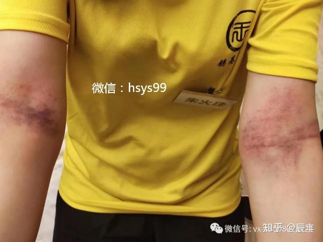 拍打疗法是什么原理,经络拍打养生法 - 知乎