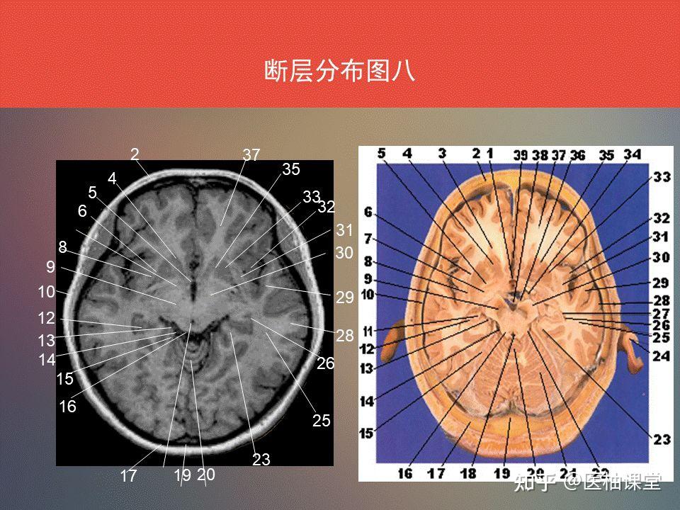 脑功能区及解剖学定位 - 知乎