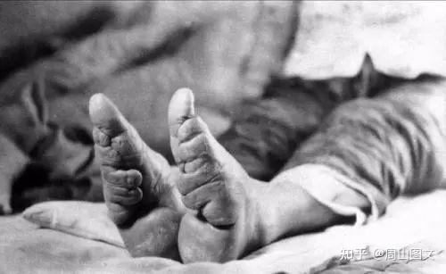 旧社会触目惊心的妇女裹脚老照片（含绣花鞋图） - 知乎