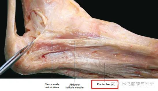 足底筋膜断裂图片