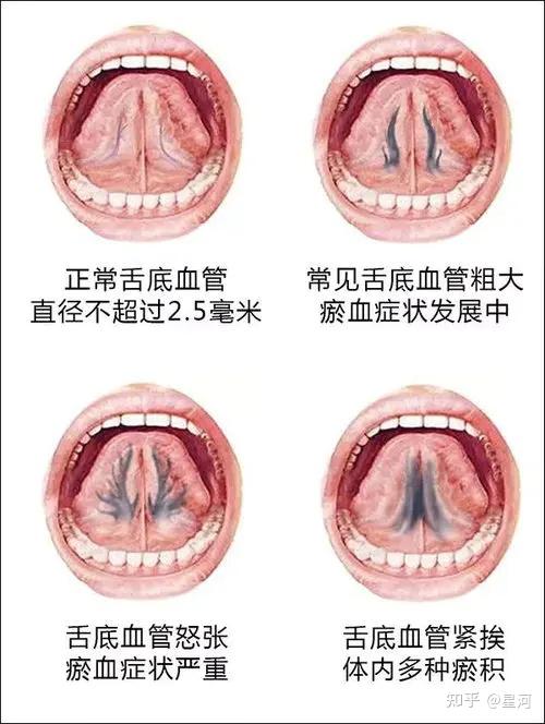 舌脉正常图片大全图片