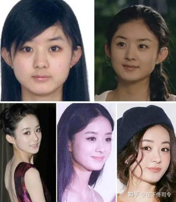 “整容成功”的这几位女星，你最喜欢谁？ - 知乎