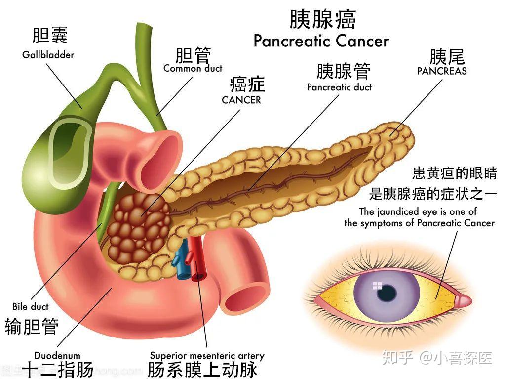 留下200亿明星黄子韬爸爸患胰腺癌去世河南名医大呼可惜