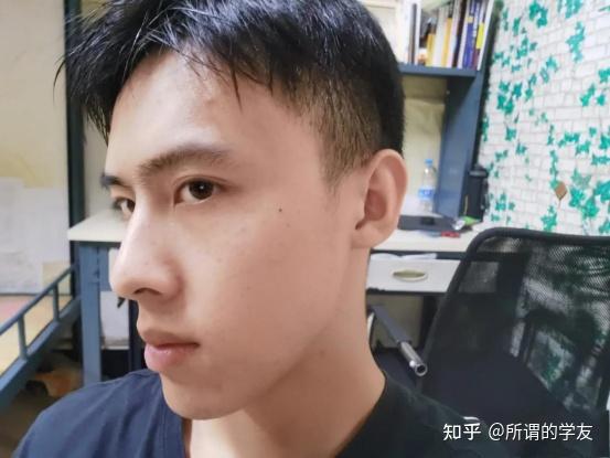 男孩子黑眼圈特别重怎么办有没有什么眼霜推荐