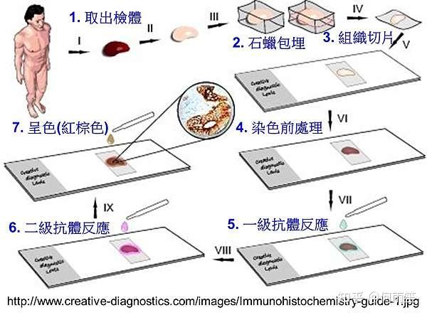 【实验技术学习笔记】免疫组织化学染色法（IHC） - 知乎