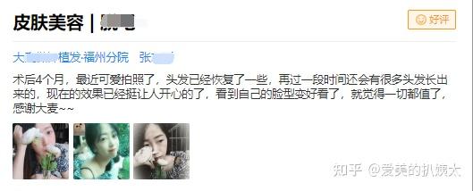 头发移植手术价格贵