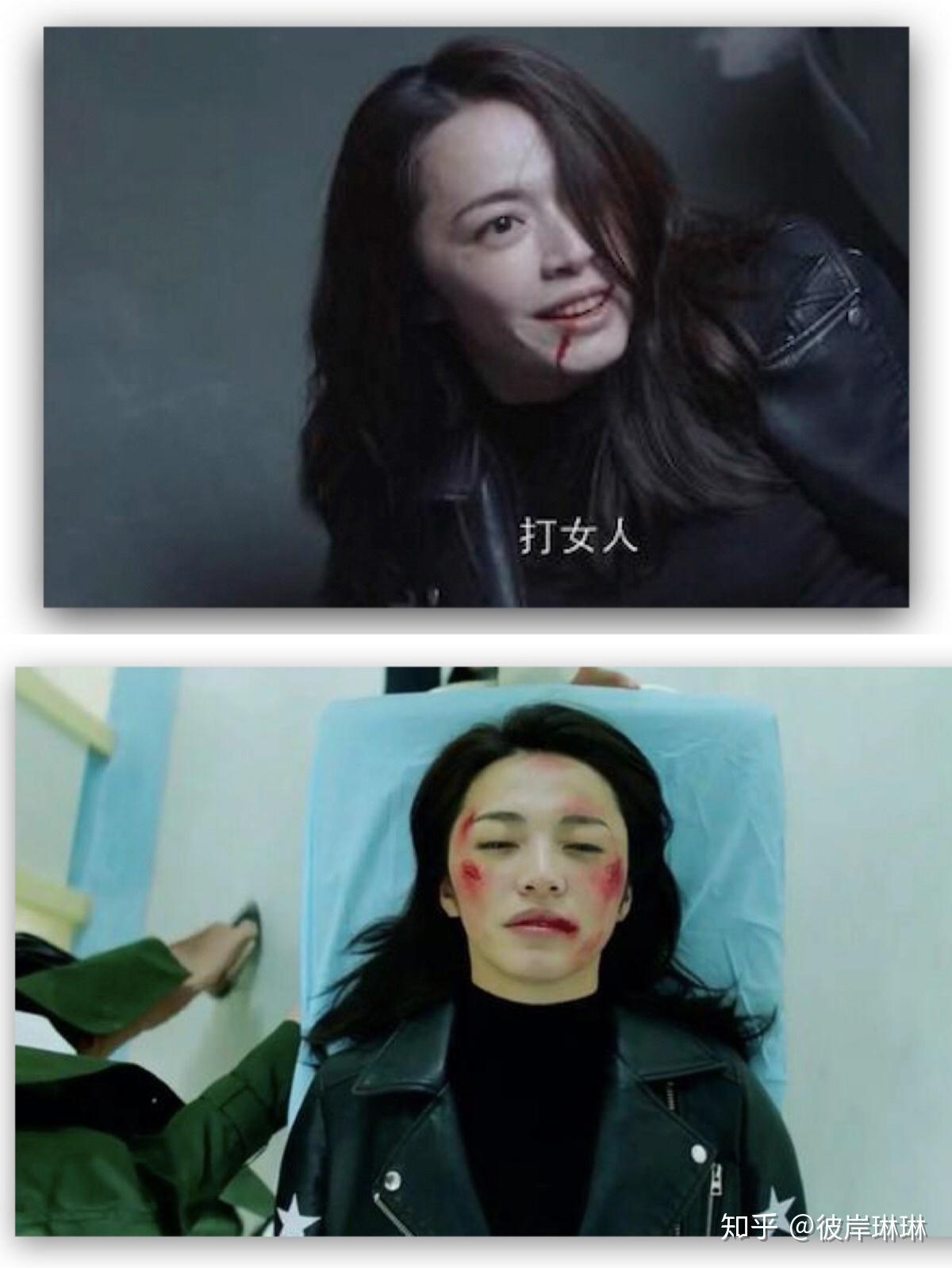 苏明玉被打到住院家暴哪些保险可以赔