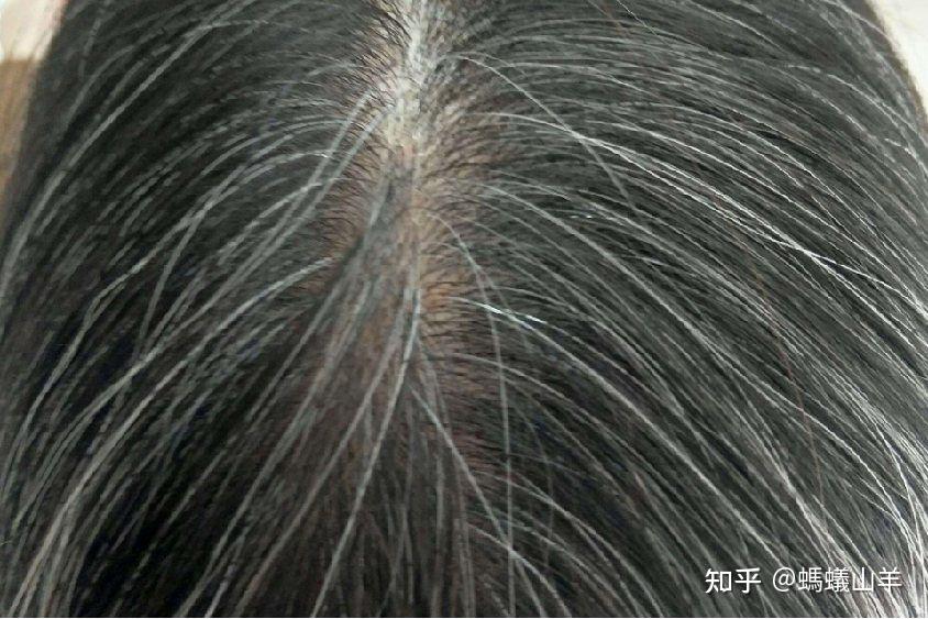 白发科普知识 - 知乎