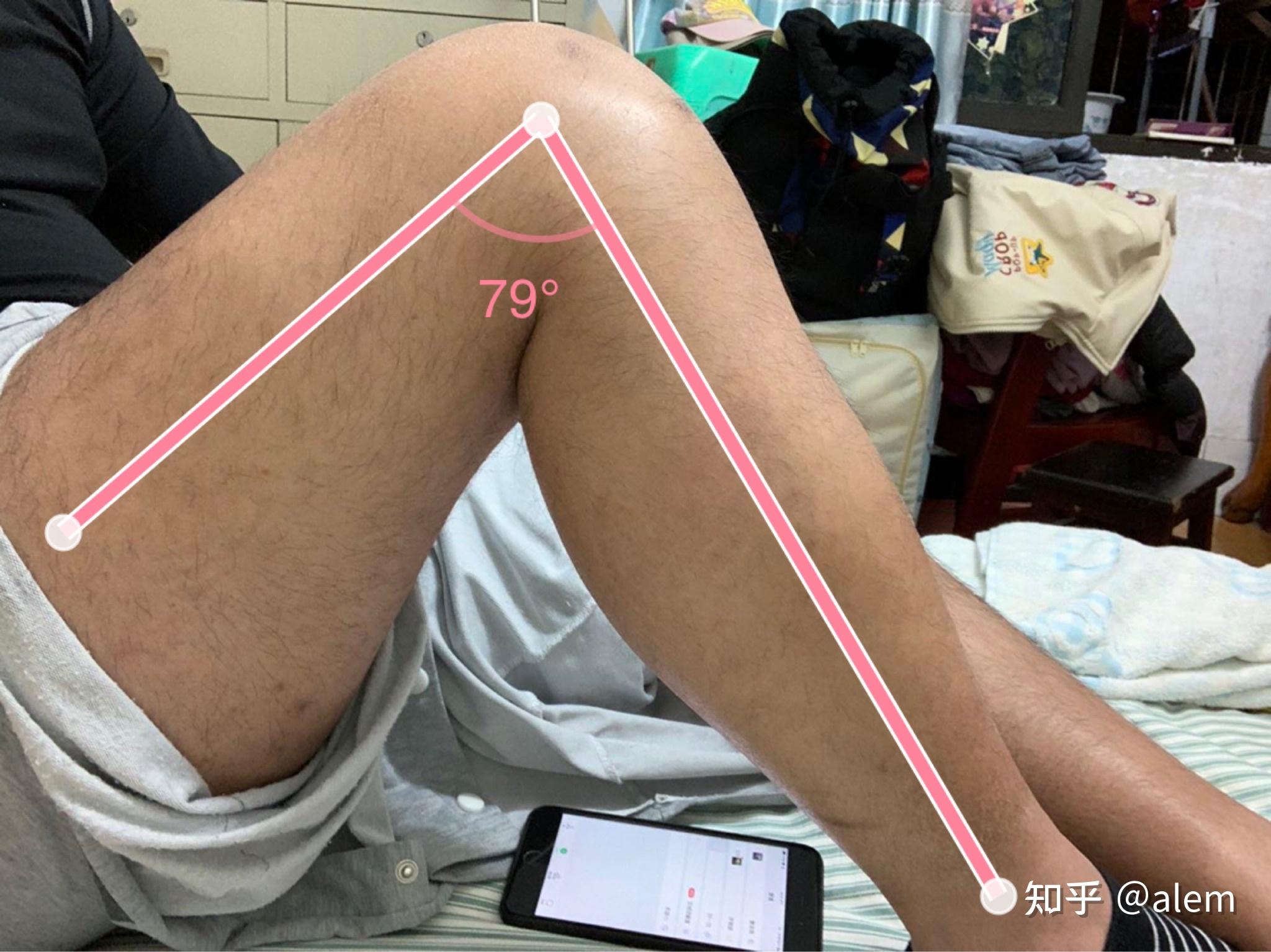 膝关节弯曲120°的图片图片