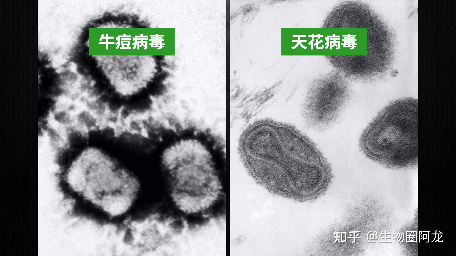 杀死5亿人的病毒3000年来人类束手无策直到一位乡村医生的疫苗出现