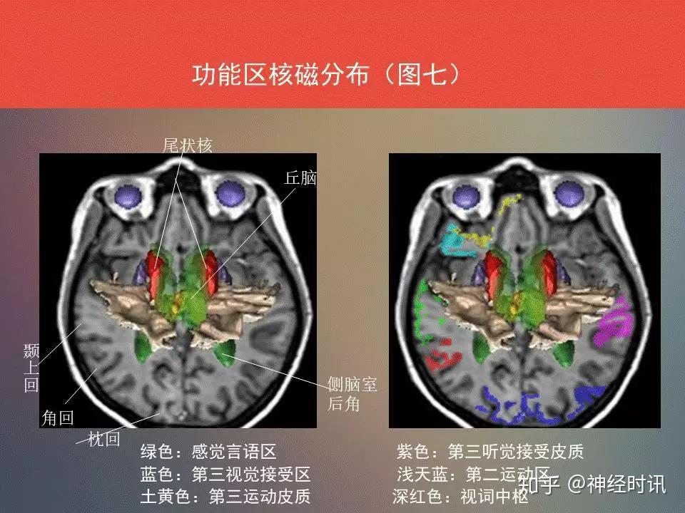 脑功能区及解剖学定位 ( 看到了,你要记得收藏 转发 ) - 知乎