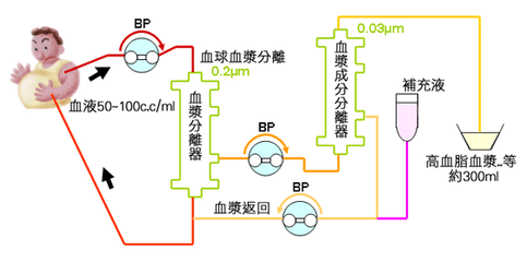 如何看待武汉一男子血液透析出2升油浆怎样养成健康的饮食习惯