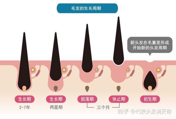 教你如何判定需要生发还是植发疗程 - 知乎