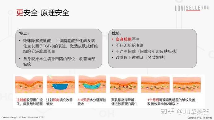 艾维岚童颜针(艾维岚童颜针官方价格)