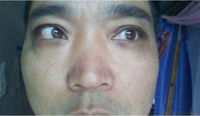 1,青色主血瘀,肝病,寒证,痛证和惊风,多因为气血运行不畅所导致.