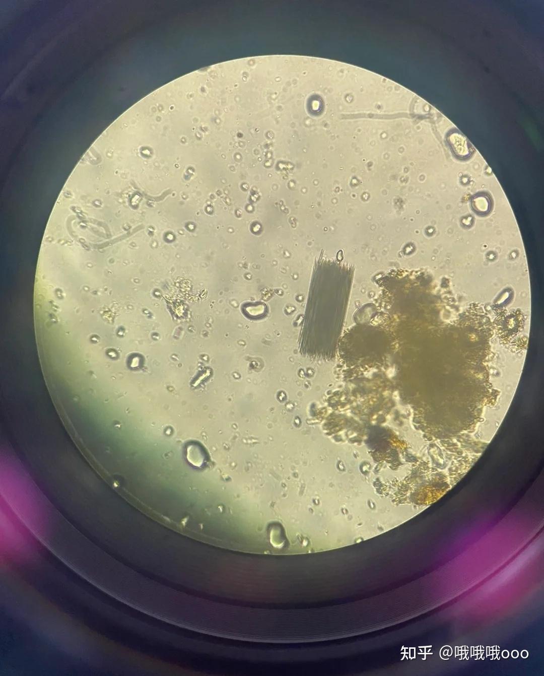 脚气真菌显微镜图片图片