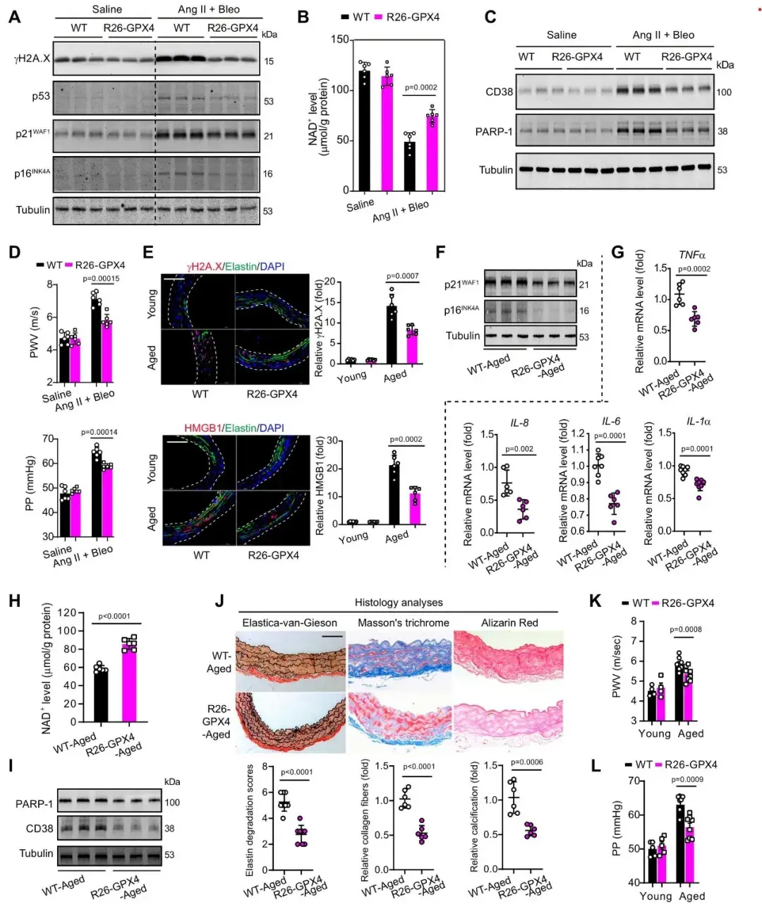 项目文章|Nature Communications|IF=14.7|铁死亡信号驱动的动脉血管衰老研究 - 知乎
