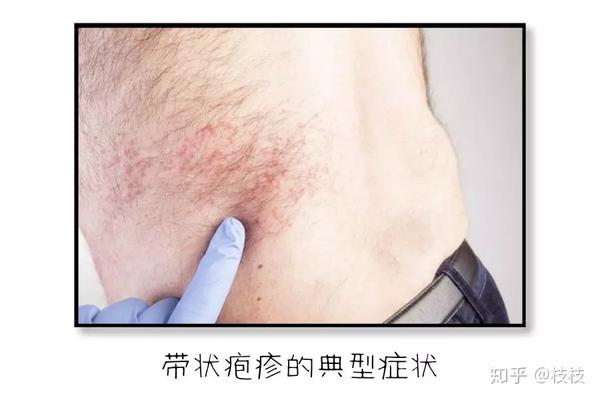 民间有一种说法:" 当蛇头和蛇尾相连接的时候,这个人就要死掉了"