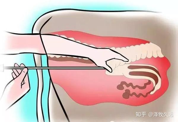 牛人工授精 全套详解来啦 附图文 知乎