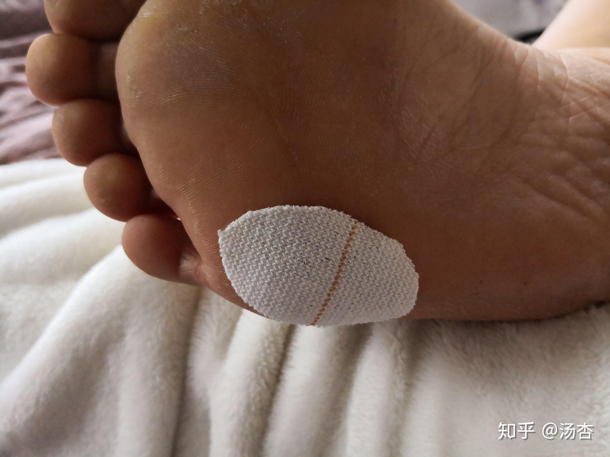 吃土少女的脚底保护的胶带的使用方法