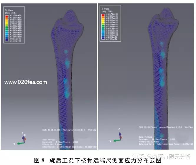 尺骨頭幾何中心在橈骨乙狀切跡上的投影點為原始標誌點17通過軟件