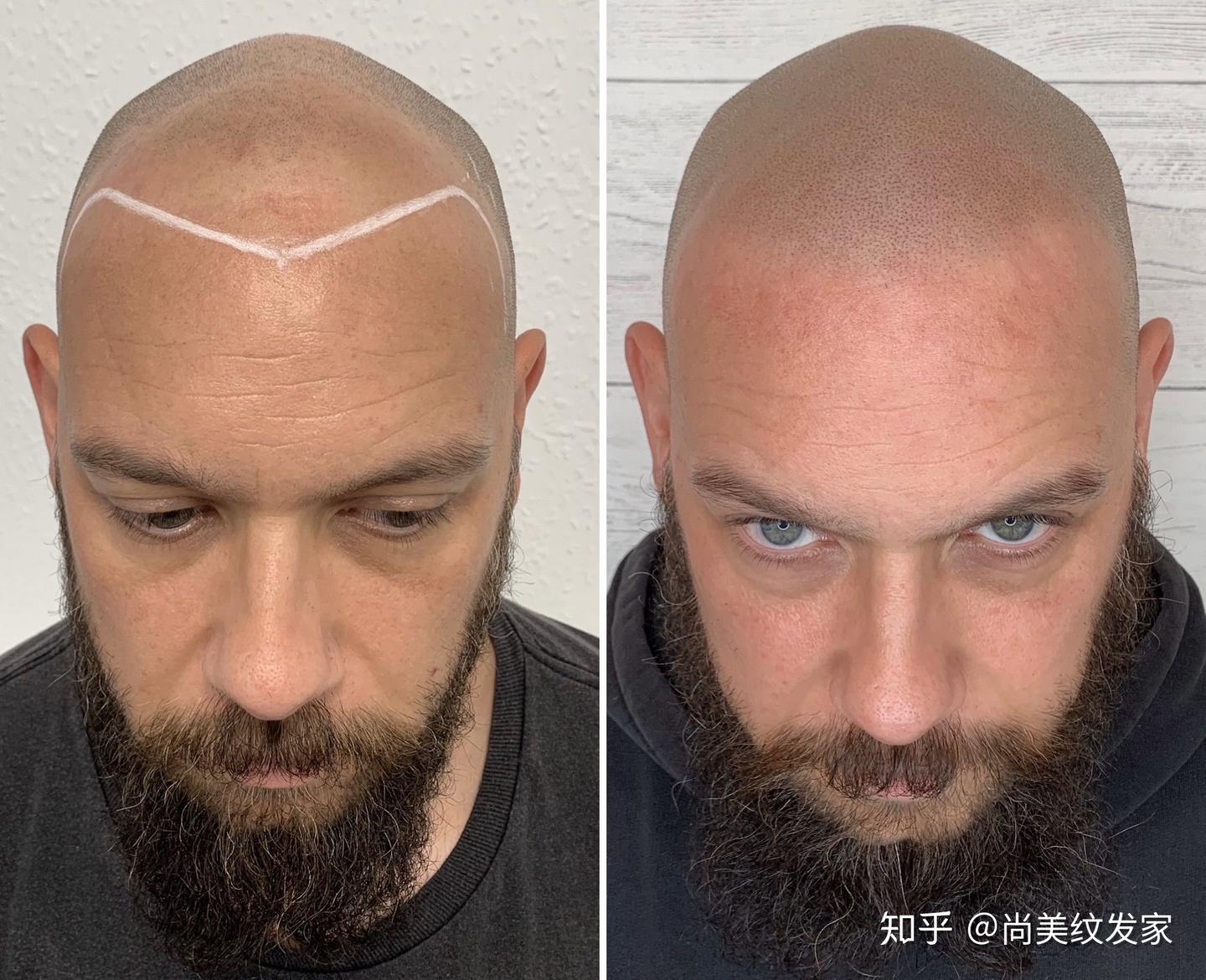 纹发是什么效果？看看国外纹发大师的杰作 - 知乎