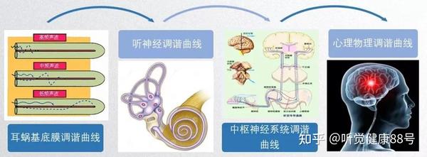 什么是听神经的调谐曲线? - 知乎