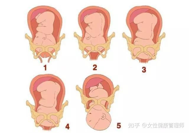 软产道的组成部分图片