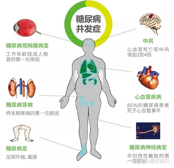 糖尿病并发症到了哪种程度?一看便知!