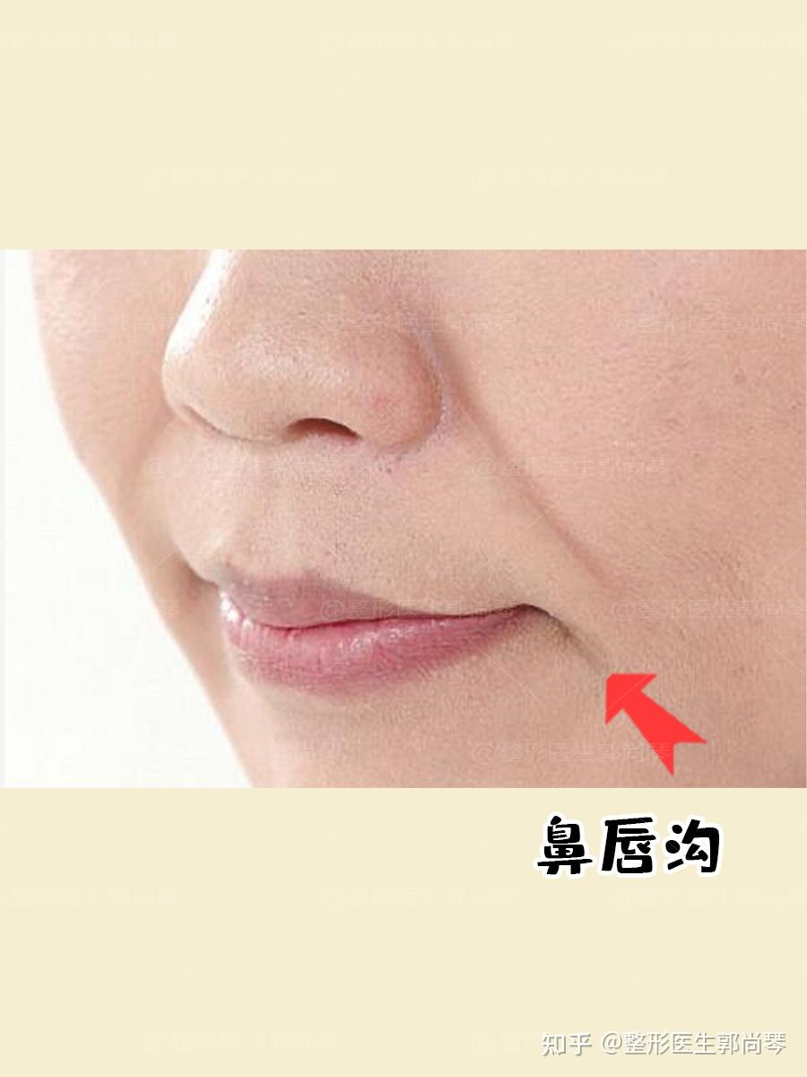 鼻唇沟=法令纹？错！ - 知乎